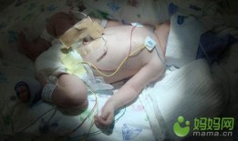 温州现“手掌婴儿”出生时仅1.6斤差点被父母放弃 盘点全球奇迹宝宝