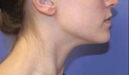女人脖子后面有痣代表含义大全