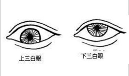 【观相识人】“一白眼、二白眼、三白眼、四白眼”面相的人命运有什么特点？
