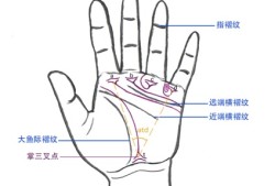 掌纹能诊断疾病吗？