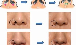 十六种鼻子面相图文分析