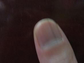 指甲长坚纹是为什么？