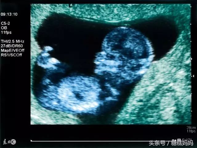 母狗第一次怀孕有哪些明显征兆_怀儿子最明显的征兆_孕妇二胎怀男孩的征兆
