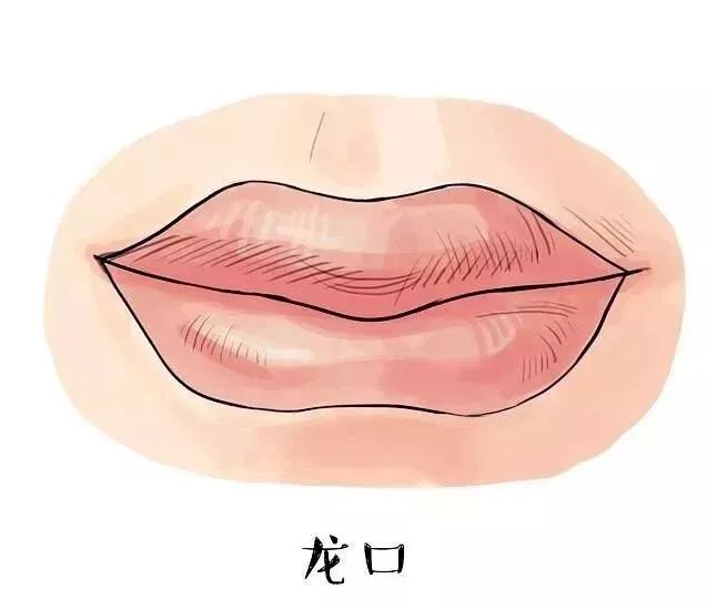 嘴唇厚_嘴唇厚整形图片_上嘴唇薄下嘴唇厚是什么嘴型