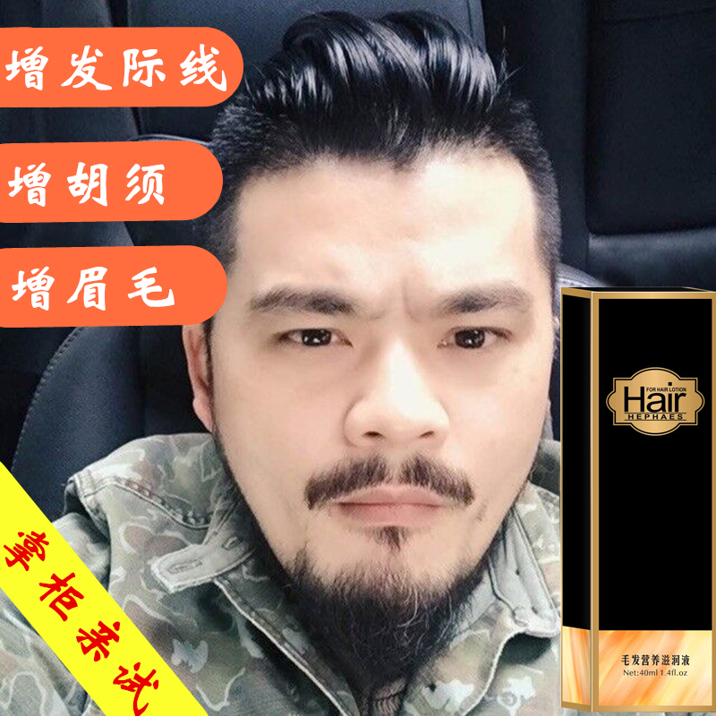 头发少细怎么办_头发细又软又少的女人命运_头发少软适合造型产品