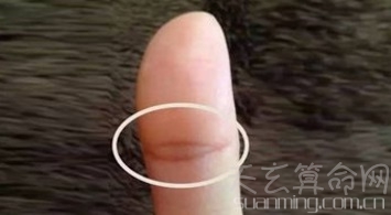 大拇指有佛眼是什么意思 暗示男娶富妻女嫁贵夫