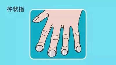 指甲上的月牙_男性指甲上的月牙代表什么_指甲上有月牙代表什么