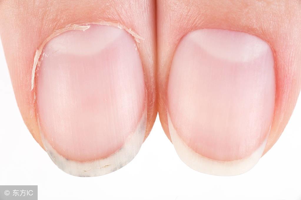 指甲上的月牙_指甲月牙上的肉红肿_指甲上的小月牙代表什么