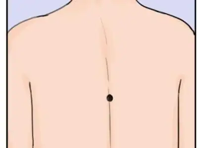 3、女人后背痣的位置与命运图解:女人后背痣的位置与命运图解
