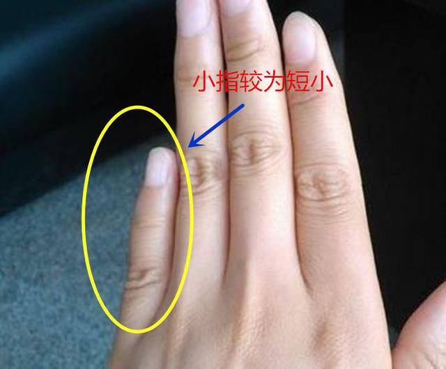 小手指短_手指短粗涂什么颜色的指甲油好看_手指短 戒指