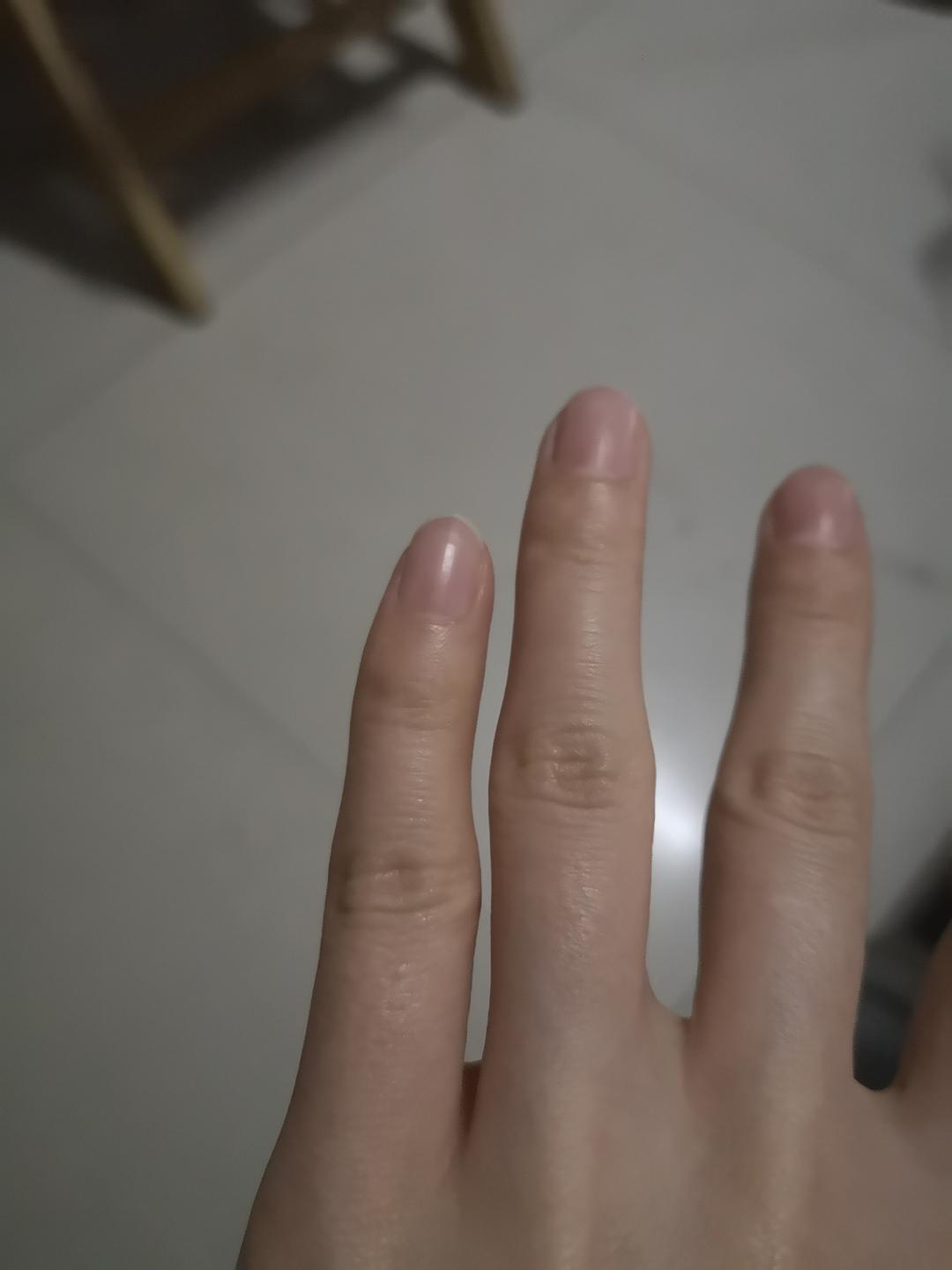 小手指短_手指短一节是什么疾病_蔻丹甲手指短
