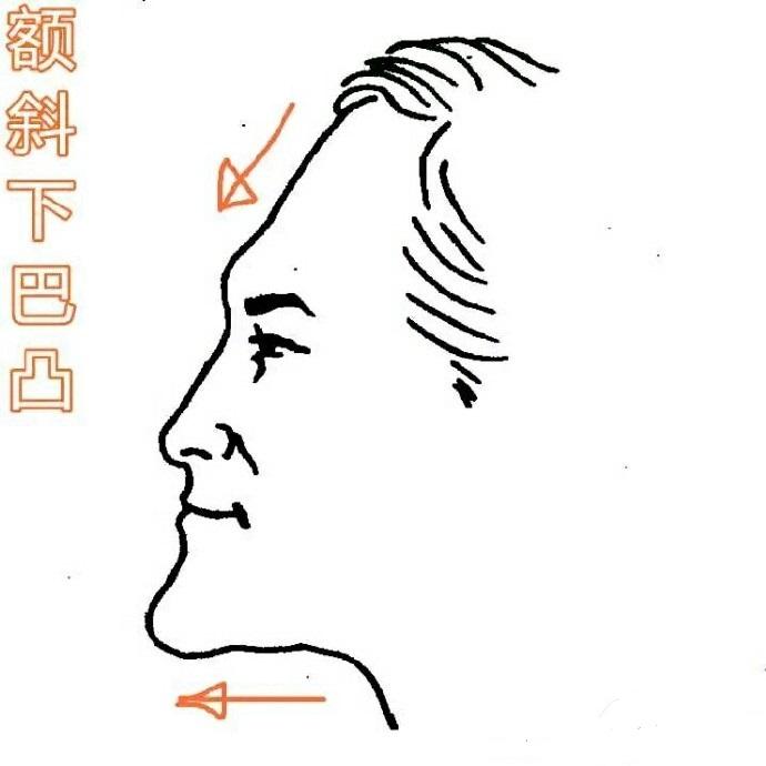 额头窄的男人面相_男人额头面相_额头后倾的男人面相