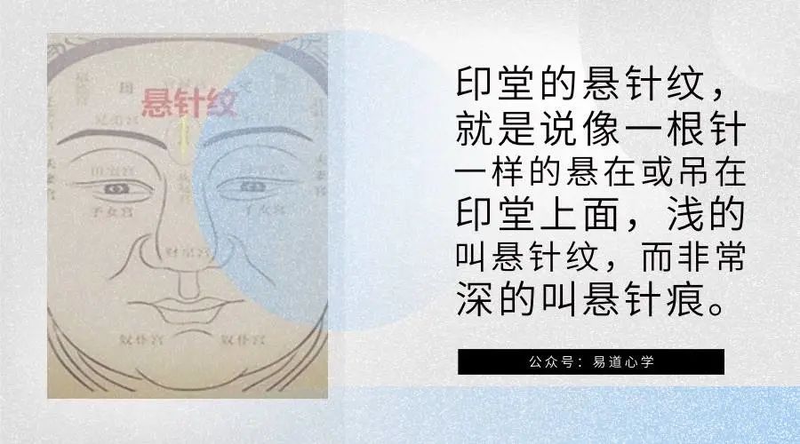 眉上竖纹_眉间有竖纹能做掉吗_两眉间有竖纹